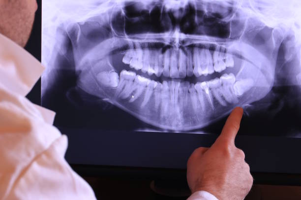 Best Urgent Care for Lost Fillings or Crowns in Fourche Crossing, LA
